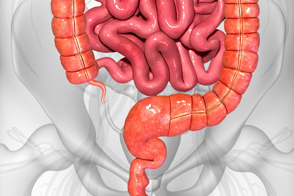 Bağırsak Tıkanıklığı: Nedenleri ve Tedavi Yöntemleri Nelerdir?