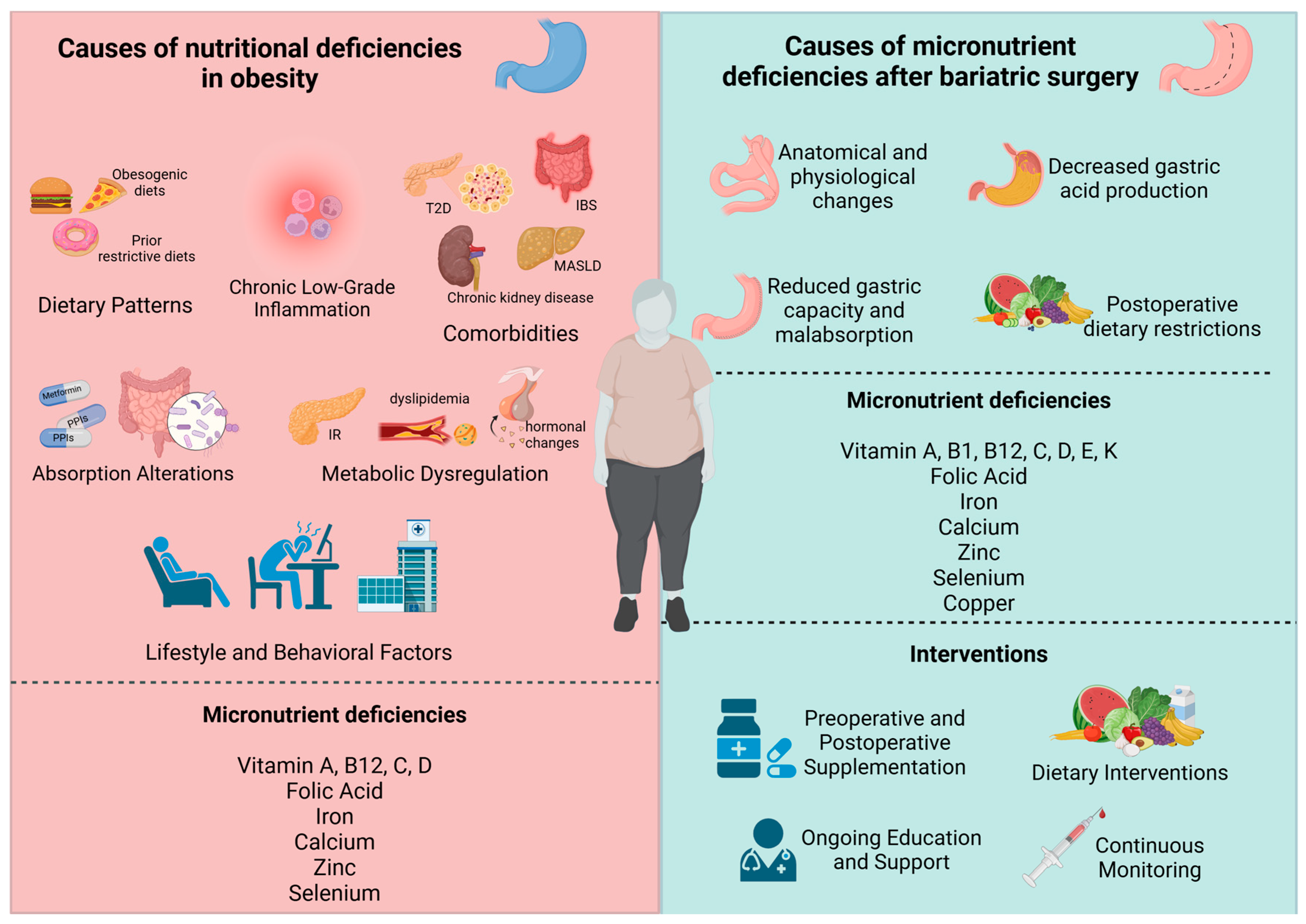 Obesite cerrahisi sonrası vitamin eksikliği nasıl önlenir